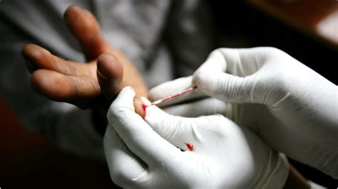 Four Common Types Of HIV Tests Available Today Tests To Diagnose HIV