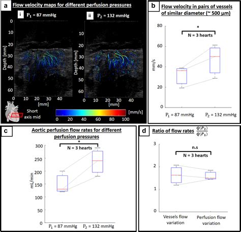 Assessment Of Coronary Microcirculation Alterations In A Porcine Model