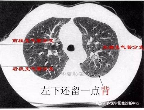 肺ct解剖分段