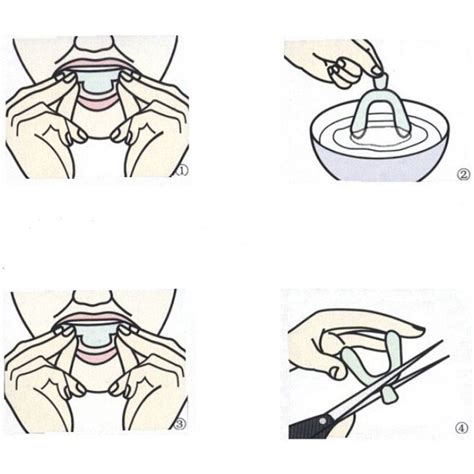 ready stock teeth whitening bleaching tray msli dental supplies