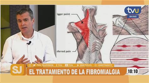 TVU on Twitter MatinalSiempreJuntos El kinesiólogo y quiropráctico