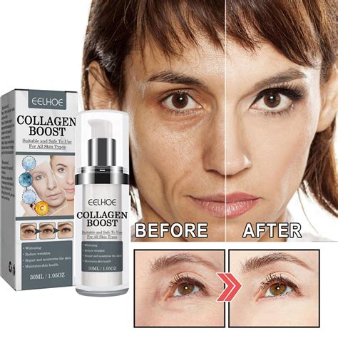 Collagen Boost Anti Aging Joopzy