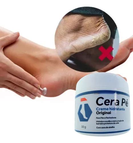 Hidrata Para P Creme Para Suavizar A Pele Anti Ressecamento