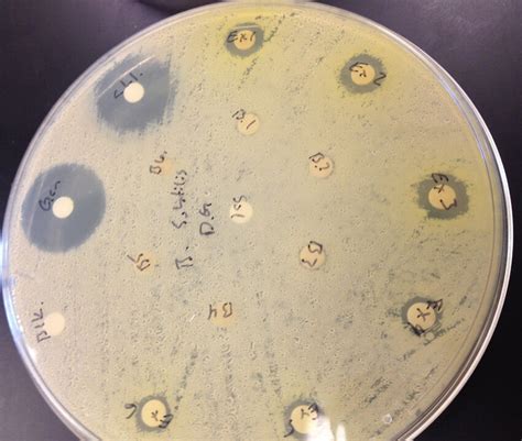 Representative Image Of Agar Plate Containing B Subtilis From A Disk