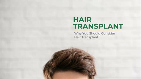 Ppt Why You Should Consider Hair Transplant Powerpoint Presentation