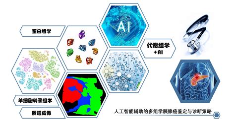 尹玉新教授团队成功开发人工智能辅助代谢组学诊断胰腺癌的新方法 生物通