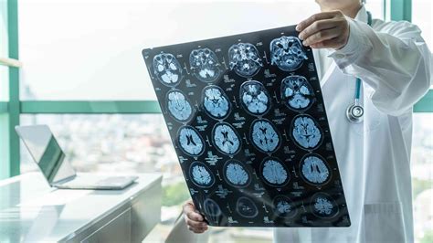 Tipos De Lesión Cerebral Traumática Medicina Básica