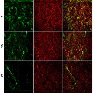 Progressive Loss Of Th Cells In The Snc After A Ohda Injection