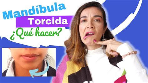 Sabes Qu Paso Aqu Mandibula Torcida Youtube