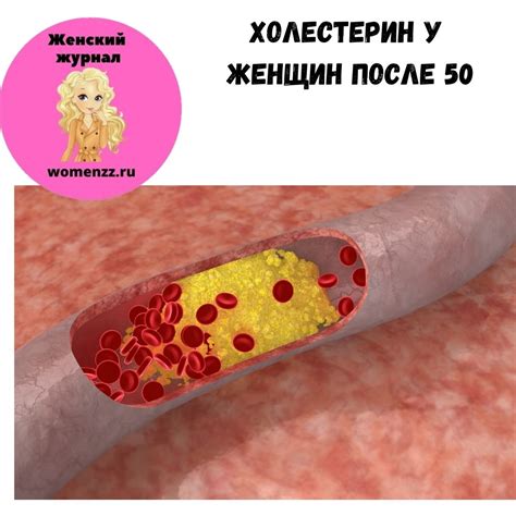 Холестерин у женщин после 50 лет: норма холестерина у женщин в 60