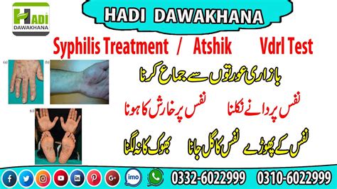 Atshik Ka Ilaj Atshik Ki Alamat Syphilis Treatment H Flickr