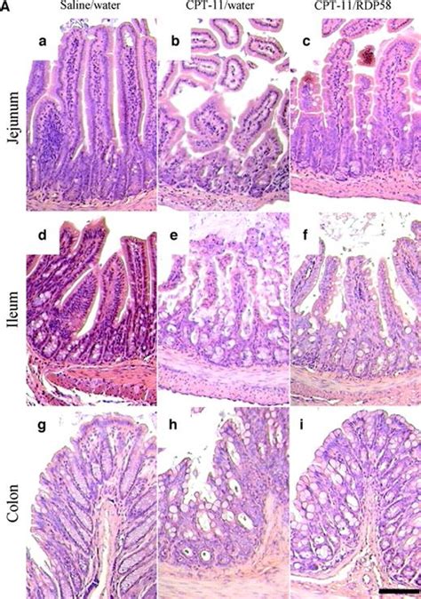 Oral Rdp58 Allows Cpt 11 Dose Intensification For Enhanced Tumor