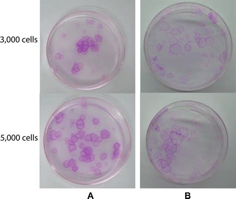 The Colony Forming Assay Of The Oral Mucosal Epithelial Cells From