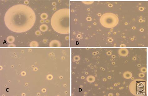 Cells after being examined by the inverted microscope: (a) fat cells ...