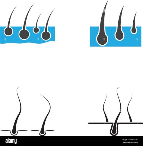 Loss Of Skin Epidermis Cut Out Stock Images Pictures Alamy