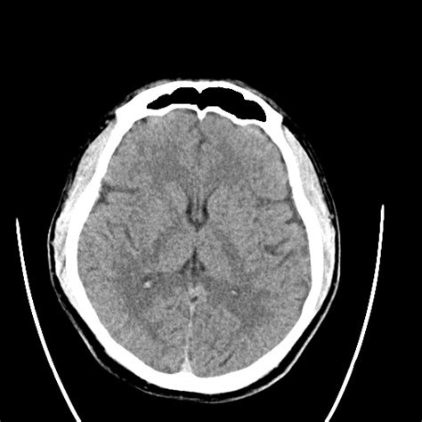 Image Radiopaedia Org