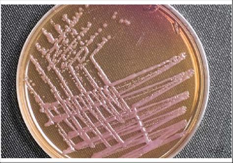 Macconkey Agar Lactose Fermentation