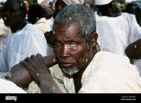 Onchocerciasis View Of A Male Farmer Blinded By Onchocerciasis River