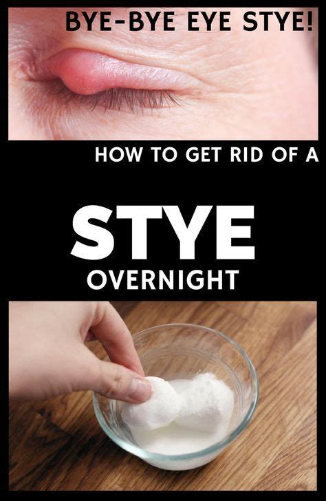 How To Get Rid Of A Stye Overnight Eye Stye Remedies Stye Stye Remedy