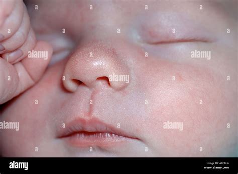 newborn white dots  nose white spots  face whats causing