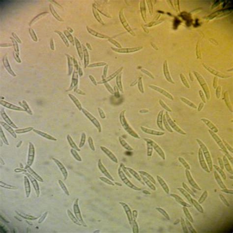 Symptom Of Fusarium Wilt Fungi On Banana And Purified Pathogen A Download Scientific Diagram