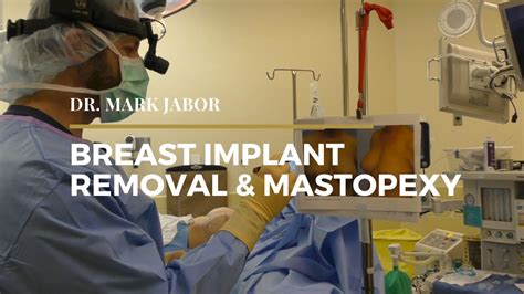 Bilateral Implant Removal with Breast Lift | Dr. Mark Jabor - YouTube