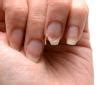 Fingernails Vitamin Deficiency | LoveToKnow