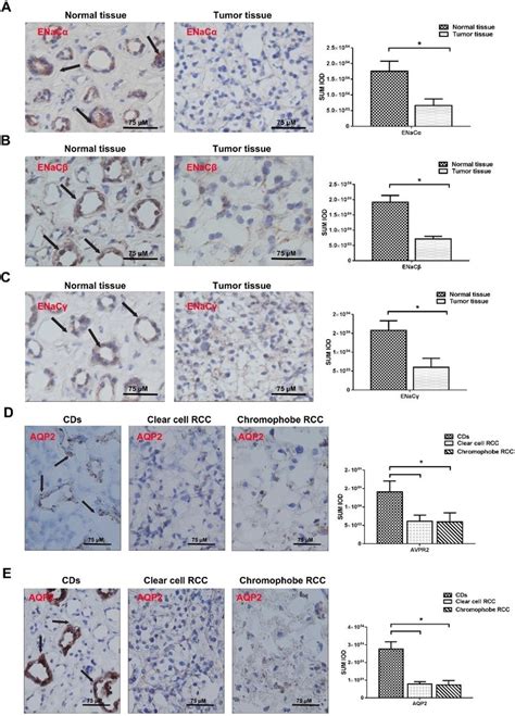 Enacs Aqp And Avpr Expression Is Attenuated In Rcc Tissue A The