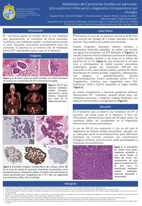 Pdf Met Stasis De Carcinoma Tiroideo En P Ncreas Sitio Anat Mico