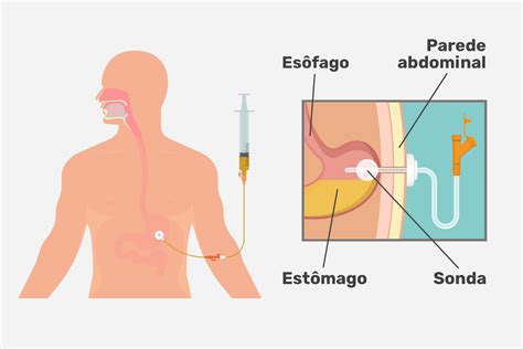 Top 16 Como Desconectar O Facebook Do Instagram 2022