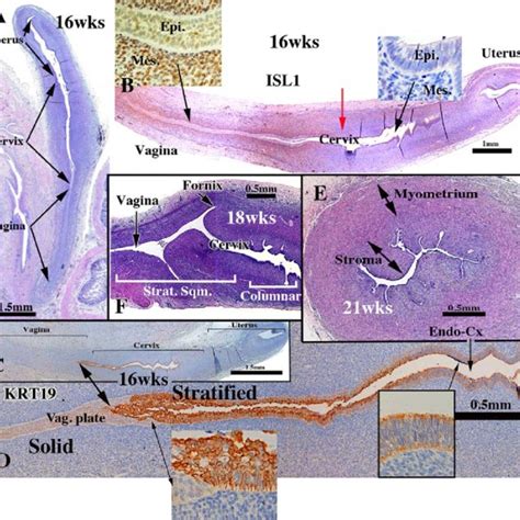 (PDF) Development of the human female reproductive tract