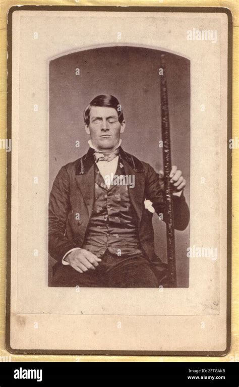 Phineas Gage Hi Res Stock Photography And Images Alamy