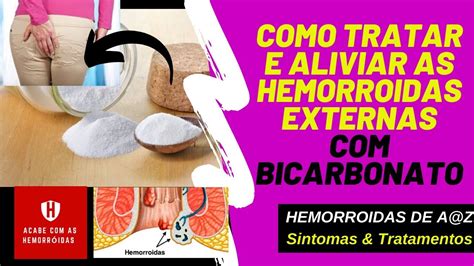 Bicarbonato Para Hemorroidas 💜💜como Tratar E Aliviar As Hemorroidas