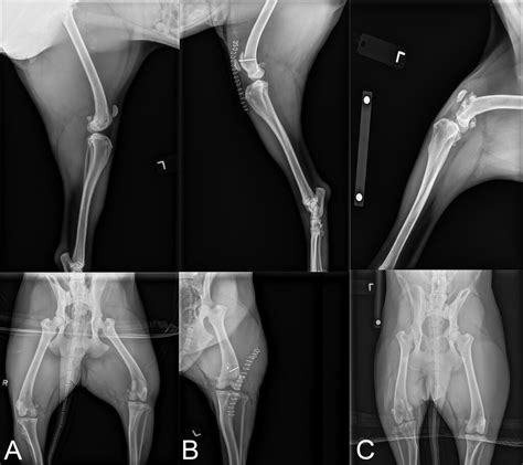 Dome Trochleoplasty For Correction Of Patella Alta And Patella Luxation