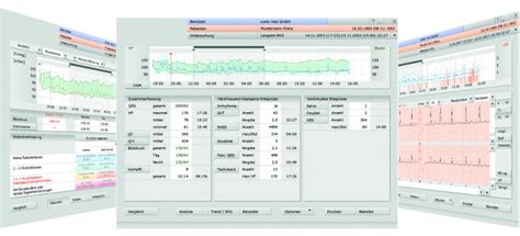Langzeit Blutdruck Langzeit Ekg In Einem Ger T Von Custo Med