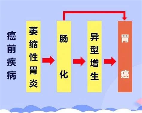 胃炎到胃癌需要几步？两项检查，有效预防胃癌