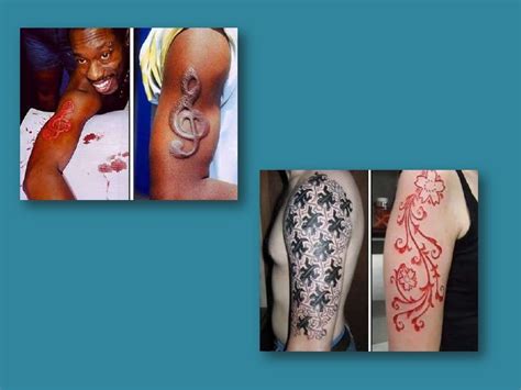 Scarification