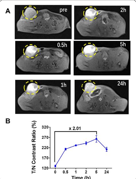 Mri Imaging T1wi Of 4t1 Orthotopic Tumor Model After Intratumoral