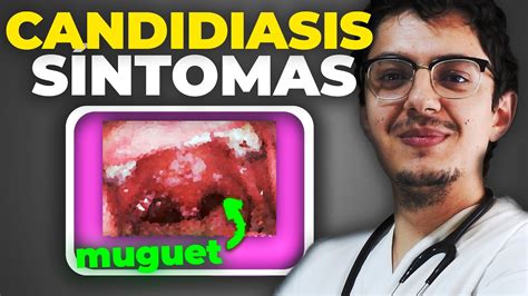 CANDIDIASIS VAGINAL y ORAL Síntomas y TRATAMIENTO contra Candida