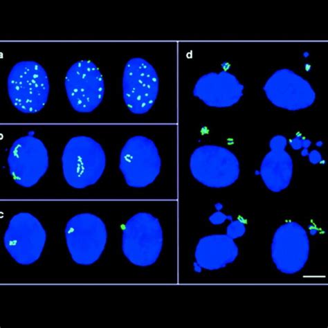 Cell Cycle Arrest And DNA Repair Synthesis Of Rad51 Focipositive