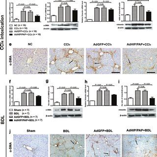 Ectopic Expression Of HIP PAP Inhibits Activation Of Hepatic Stellate