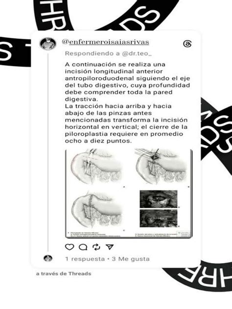 Piloroplastia Enfermero Isaias Rivas Enfermeroisaiasrivas UDocz