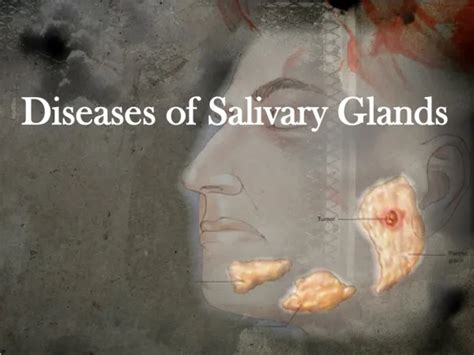 Ppt Salivary Glands And Saliva Powerpoint Presentation Free Download Id2228551