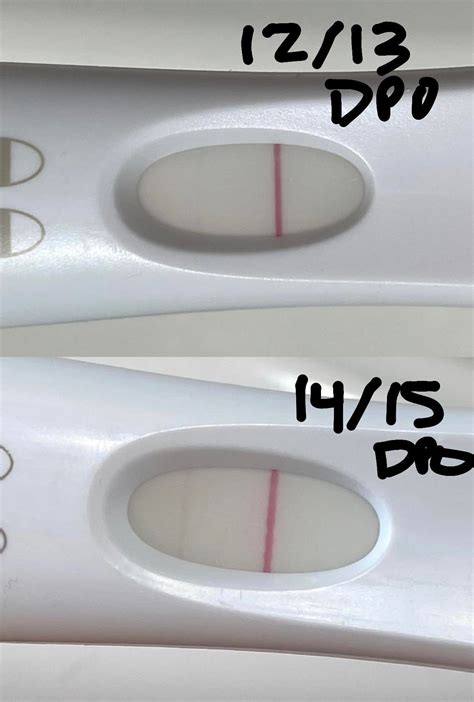 Did anyone have lines this light at 14/15 dpo that has a success story