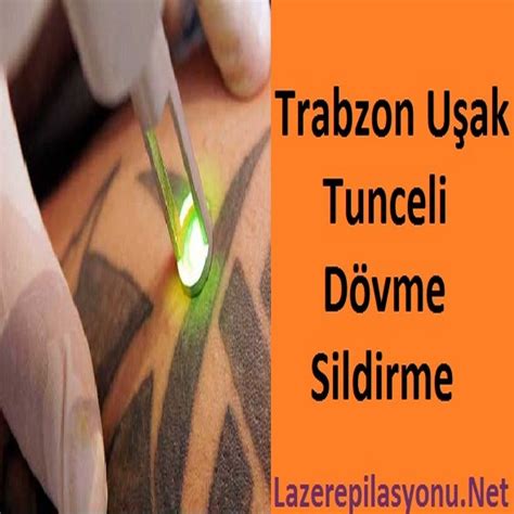 Trabzon Tunceli U Ak D Vme Sildirme Lazer Epilasyonu Lazer Epilasyon