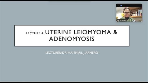 Leiomyoma And Adenomyosis Youtube