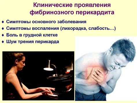 Перикардит. Классификация перикардитов - презентация онлайн