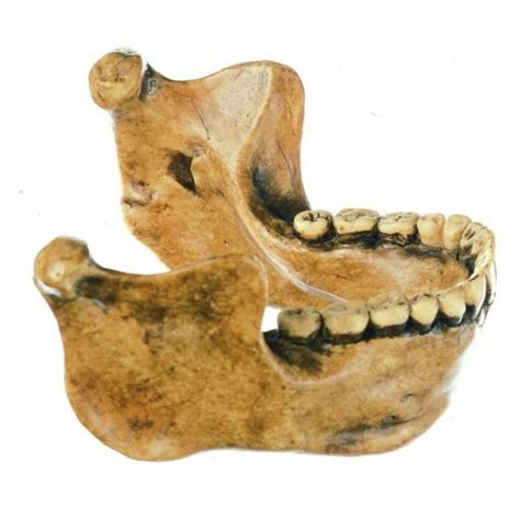 S 11 The Steinheim Skull Homo heidelbergensis | Biomedical Models