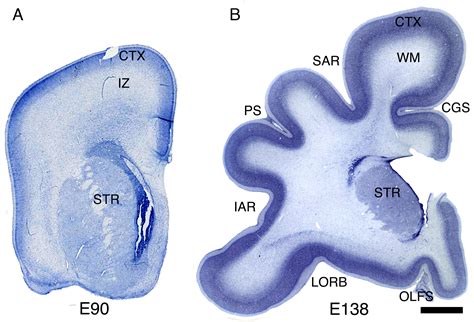 Rhinal Cortex Sectioned View