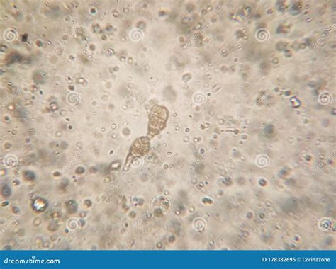 Microscopy of the Alternaria Fungus Macroconidia Stock Image - Image of ...